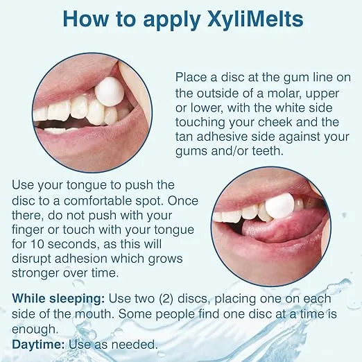 OraCoat XyliMelts Dry Mouth Relief Oral Adhering Discs Mild Mint with Xylitol, for Dry Mouth, Stimulates Saliva, Non-Acidic, Day and Night Use, Time Release for up to 8 Hours, 230 Count